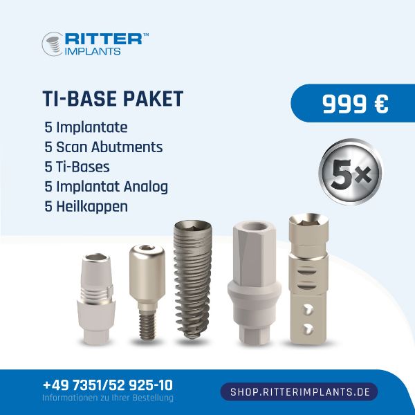 Ritter Implants Ti-Base Paket 5 Implantate  5 Scan Abutments  5 Ti-Bases  5 Implantat Analoge  5 Heilkappen 999 Euro