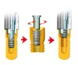 Picture of Standard Line Extractor Kit