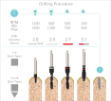 Ritter Implants iOS3 Conical Connection Implant OS-SP D:3.1mm L-13mm